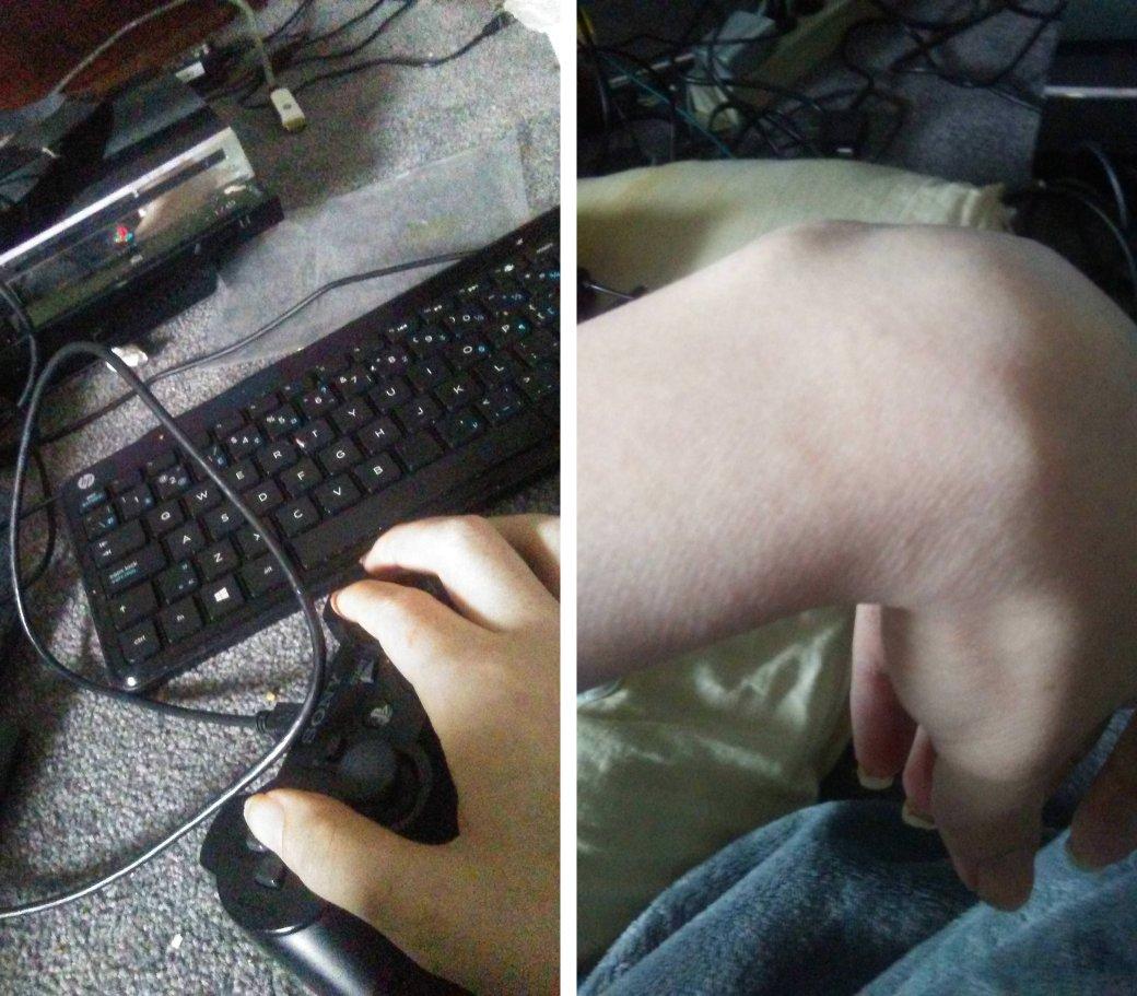 Как парень с ДЦП научился играть в Overwatch одной рукой